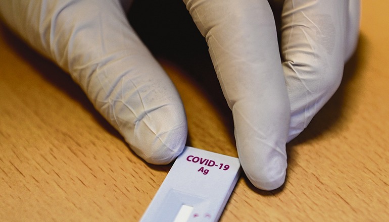 Es werden PCR- und Antigen-Testergebnisse akzeptiert. Foto: EFe