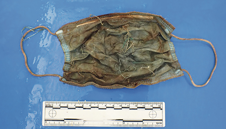 Unverdaulich: Bei der Nekropsie eines weiblichen Delfins, der an der Küste von Teneriffa tot aufgefunden wurde, entdeckten die Wissenschaftler eine chirurgische Maske und jede Menge Plastik. Foto: EFE/ULPGC